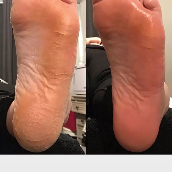 Peau rugueuse réduite