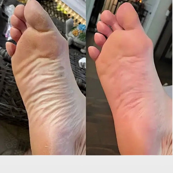 Contour du talon