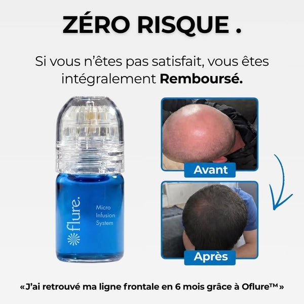 Oflure™ Micro‑Infuse - Densité & Repousse Capillaire.