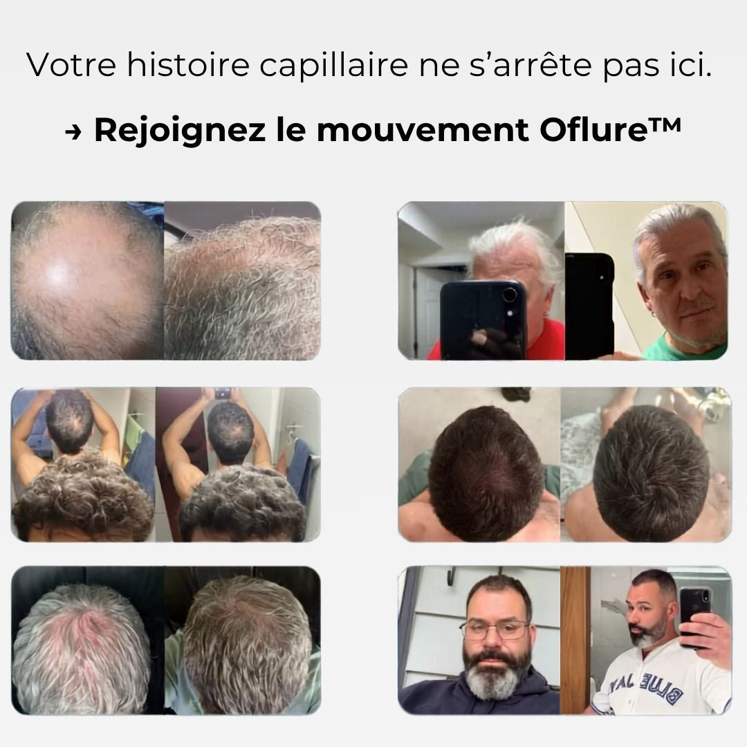 Oflure™ Micro‑Infuse - Densité & Repousse Capillaire.